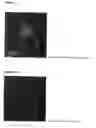Fig. 02 - FLUORESCENT IMAGING OF SKIN CANCERS USING PHOSPHOLIPID ETHER COMPOUNDS