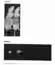 Fig. 06 - FLUORESCENT IMAGING OF SKIN CANCERS USING PHOSPHOLIPID ETHER COMPOUNDS