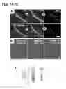Fig. 09 - Compositions and methods for CaMKII inhibitors and uses thereof