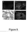 Fig. 10 - Novel Neurotrophic Factor Protein and Uses Thereof