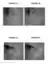 Fig. 08 - Cosmetic treatment system and methods