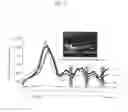 Fig. 10 - Drug delivery system