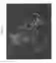 Fig. 06 - Vaccination by transcutaneous targeting