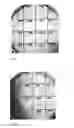 Fig. 02 - System comprising bacteriophages and particles that contain active substances