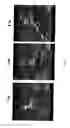 Fig. 06 - ANTIMICROBIAL AGENT FOR GRAM-POSITIVE BACTERIA