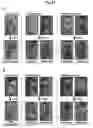 Fig. 32 - Use of lignan compounds for treating or preventing inflammatory disease