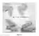 Fig. 09 - HERBAL COMPOSITION FOR MAINTAINING/CARING THE SKIN AROUND THE EYE, METHODS OF PREPARING THE SAME AND USES THEREOF