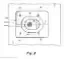 Fig. 08 - Method and apparatus for coupling and uncoupling an injection valve pin