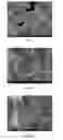 Fig. 02 - METHOD FOR FILTERING A LIQUID