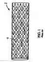 Fig. 02 - Stent coating method