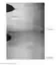 Fig. 04 - Methods for Detecting Metabolic States by Laser Ablation Electrospray Ionization Mass Spectrometry
