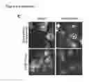 Fig. 08 - Detection of sub-cellular compartment localization of a molecule using a reduced affinity enzyme complementation reporter system