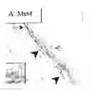 Fig. 01 - Monoclonal antibody which binds cMet (HGFR) in formalin-fixed and paraffin-embedded tissues and related methods