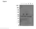 Fig. 08 - E.Coli Host Cells with Modified Phos/Psts Periplasmic Phosphate-binding Proteins, and Method of Manufacturing Recombinant Fabs