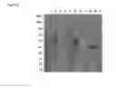 Fig. 09 - E.Coli Host Cells with Modified Phos/Psts Periplasmic Phosphate-binding Proteins, and Method of Manufacturing Recombinant Fabs