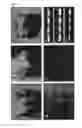 Fig. 02 - VARIOUS HUMAN DENTAL STEM CELLS HAVING A MINERALIZATION ABILITY AND THE METHOD FOR CULTURING THEM