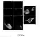 Fig. 07 - Method for extracellular matrix mediated differentiation and proliferation of stem cells