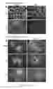 Fig. 08 - Generation of pluripotent cells from fibroblasts