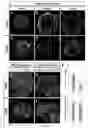 Fig. 09 - Generation of pluripotent cells from fibroblasts
