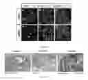 Fig. 11 - Generation of pluripotent cells from fibroblasts