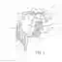 Fig. 03 - CONNECTOR ASSEMBLY FOR AN IMPLANTABLE MEDICAL DEVICE AND PROCESS FOR MAKING