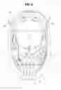 Fig. 05 - Outboard engine unit