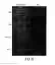 Fig. 07 - Diagnostic tool for diagnosing benign versus malignant thyroid lesions