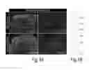 Fig. 02 - ANTI-BACTERIAL COMPOSITIONS