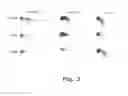 Fig. 04 - DETECTION OF TISSUE ORIGIN OF CANCER