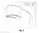 Fig. 06 - DETECTION OF TISSUE ORIGIN OF CANCER