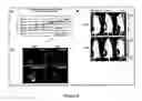Fig. 06 - Modified H2 relaxin for tumor suppression