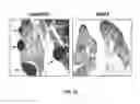 Fig. 34 - Use of opioid antagonists