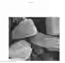 Fig. 04 - Method and composition to improve absorption of therapeutic agents