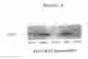 Fig. 06 - Compositions and methods for identifying agents which modulate PTEN function and PI-3 kinase pathways