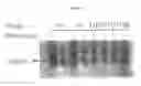 Fig. 08 - Compositions and methods for identifying agents which modulate PTEN function and PI-3 kinase pathways