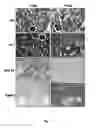 Fig. 08 - METHOD FOR IDENTIFYING A RENAL FIBROSIS PROCESS USE OF SNAIL- ACTIVITY-INHIBITING COMPOUNDS IN  THE PRODUCTION OF PHARMACEUTICAL COMPOSITIONS, METHOD FOR IDENTIFYING SAID INHIBITING COMPOUNDS, SAID PHARMACEUTICAL COMPOSITIONS AND APPLICATIONS THEREOF