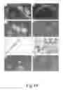 Fig. 25 - ANTISENSE OLIGONUCLEOTIDES FOR TREATING ATOPIC DISEASES AND NEOPLASTIC CELL PROLIFERATION