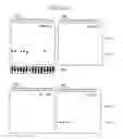 Fig. 09 - Identification of novel genes coding for small temporal RNAs