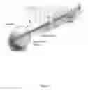 Fig. 02 - Catheter marking for multi-lumen catheter identification