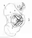 Fig. 04 - NEEDLE FOR SURGICAL THREADING AND METHOD FOR USING THE SAME