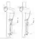 Fig. 04 - Suspension/retraction device for surgical manipulation