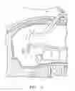 Fig. 07 - Suspension/retraction device for surgical manipulation