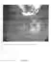 Fig. 09 - Suspension/retraction device for surgical manipulation