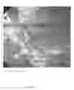 Fig. 13 - Suspension/retraction device for surgical manipulation