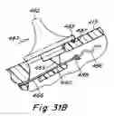Fig. 33 - Surgical instrument