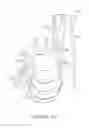 Fig. 33 - Pedicle guided retractor system