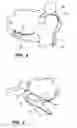 Fig. 03 - Multi-bend steerable mapping catheter