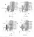 Fig. 06 - DETERMINING THE POSITION OF A NEEDLE