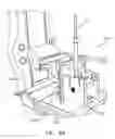 Fig. 10 - METHODS AND APPARATUS FOR PERFORMING PROCEDURES ON TARGET LOCATIONS IN THE BODY