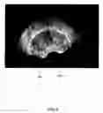 Fig. 07 - System and method for image guided prostate cancer needle biopsy